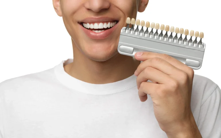 happy-young-man-with-teeth-color-samples-white-background-closeup-dental-veneers